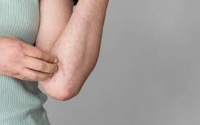 Infecção que acaba de entrar no radar do Espírito Santo