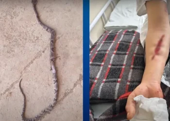 Mulher é hospitalizada após ser picada por jararaca em Domingos Martins