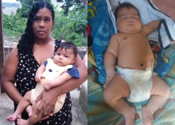Bebê de 7 kg nasce em parto normal e mãe leva 51 pontos no útero