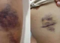 Jovem é espancada após invasão de casa e bebê de um mês também é agredido na Serra
