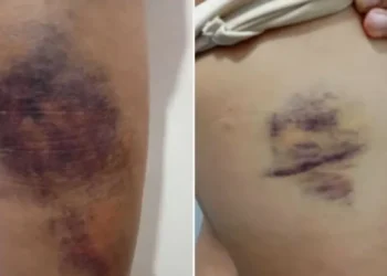Jovem é espancada após invasão de casa e bebê de um mês também é agredido na Serra